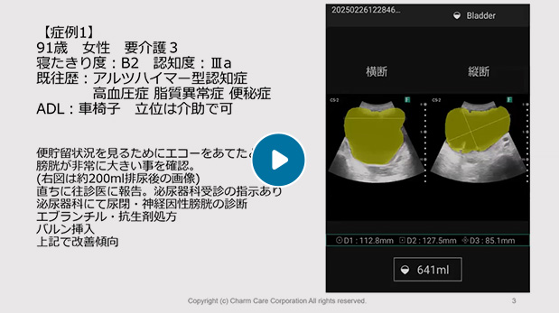 はじめての看護エコー　介護施設編