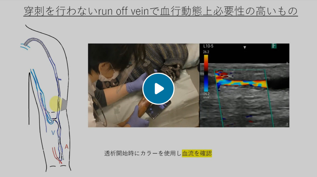 VA-POCUS